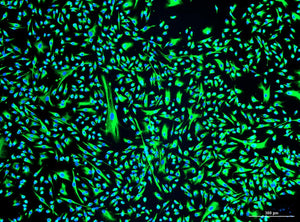 Human Prostate Carcinoma Cancer-Associated Fibroblasts (CAFs): 1,000,000 Cells