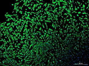 Human Head & Neck Squamous Cell Carcinoma Cancer-Associated Fibroblasts, 1,000,000 Cells, cryopreserved