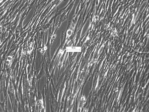 Human Lung Squamous Cell Carcinoma Cancer Associate Fibroblasts